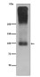 Metabotropic Glutamate Receptor 2 Rabbit mAb ABZ5078