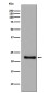 Glutathione Peroxidase 1 Rabbit mAb ABZ5079