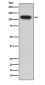 Insulin degrading enzyme Rabbit mAb ABZ5080