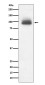 Glucocorticoid Receptor Rabbit mAb ABZ5081