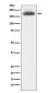Mannose Receptor/CD206 Rabbit mAb ABZ5082