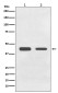 BMP11 Rabbit mAb ABZ5083
