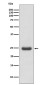 Thymidine Kinase 1/TK1 Rabbit mAb ABZ5084