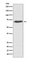 PDIA2/PDIP Rabbit mAb ABZ5085