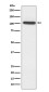 Sarcomeric alpha Actinin Rabbit mAb ABZ5086