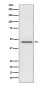 Pyruvate Dehydrogenase E1 alpha Rabbit mAb ABZ5088