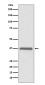 ERCC1 Rabbit mAb ABZ5090