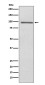 PROX1 Rabbit mAb ABZ5091