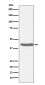 MHC Class I Rabbit mAb ABZ5092