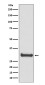 Calbindin Rabbit mAb ABZ5094