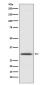 Annexin V Rabbit mAb ABZ5095