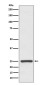 Human kappa Light Chain Rabbit mAb ABZ5096