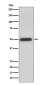 ATPB Rabbit mAb ABZ5098