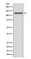 ITGA2B/CD41 Rabbit mAb ABZ5102