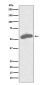 Glucose 6 Phosphate Dehydrogenase Rabbit mAb ABZ5106