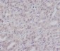 IKK gamma Rabbit mAb ABZ5107