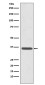 Annexin 2 Rabbit mAb ABZ5110