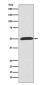 Wnt5a Rabbit mAb ABZ5111
