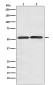 Glucose Transporter GLUT3 Rabbit mAb ABZ5115