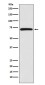cIAP1 Rabbit mAb ABZ5118