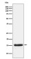 PLGF Rabbit mAb ABZ5119