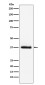 Parathyroid Hormone Rabbit mAb ABZ5120