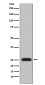 Lambda Light Chain Rabbit mAb ABZ5121