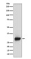 Calretinin Rabbit mAb ABZ5122
