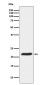 TCTP Rabbit mAb ABZ5132