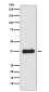 Follistatin Rabbit mAb ABZ5137
