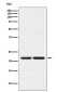 HP1 gamma Rabbit mAb ABZ5139