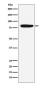 Factor XIIIa Rabbit mAb ABZ5140