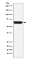 Placental Alkaline Phosphatase Rabbit mAb ABZ5145