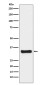 Thymidylate Synthase Rabbit mAb ABZ5147