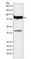 PKC eta Rabbit mAb ABZ5148