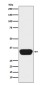 OTX1/2 Rabbit mAb ABZ5149