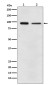 EEF2/Elongation factor 2 Rabbit mAb ABZ5150