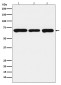 PCK2 Rabbit mAb ABZ5158