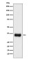 SF2 Rabbit mAb ABZ5161