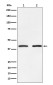 SMYD3 Rabbit mAb ABZ5163