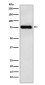LYRIC/AEG1 Rabbit mAb ABZ5165