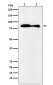 VPS35 Rabbit mAb ABZ5170