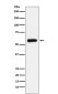 ALDH2 Rabbit mAb ABZ5171
