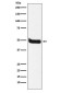 Neurokinin 1 Receptor Rabbit mAb ABZ5172