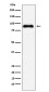 SATB2 Rabbit mAb ABZ5174