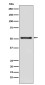 TdT Rabbit mAb ABZ5176