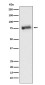 GRK3 Rabbit mAb ABZ5178