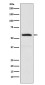 alpha Internexin Rabbit mAb ABZ5179