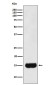 Prostate Secretory Protein Rabbit mAb ABZ5190