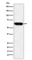E2F4 Rabbit mAb ABZ5194